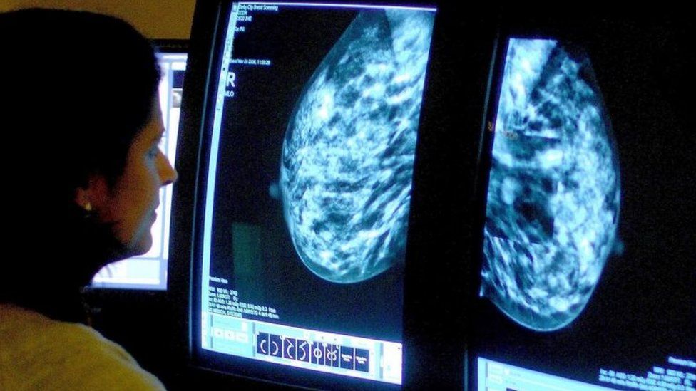 A consultant analysing a mammogram