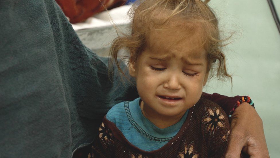 A child in a Kabul hospital cries out in pain