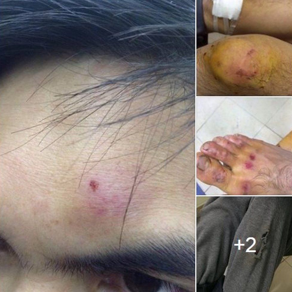 Facebook post showing alleged injuries to church members during detention