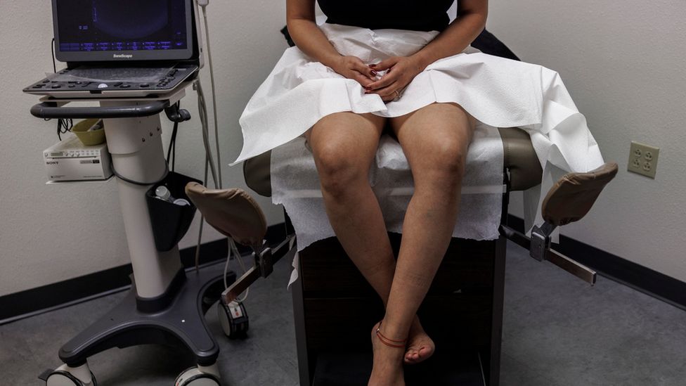 Пациентка ждет УЗИ перед медикаментозным абортом
