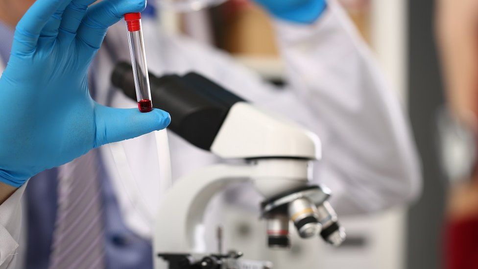 La mano con guantes azules de un hombre sostiene una probeta con sangre cerca de un microscopio