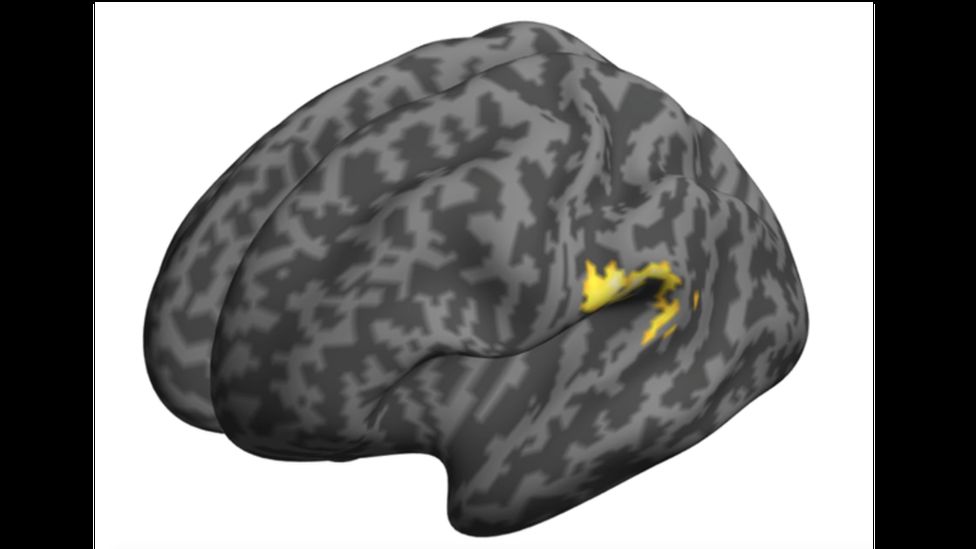 The auditory cortex (in yellow) in the brain