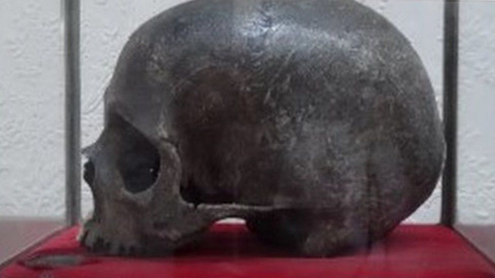 Skull of St Ambrose Barlow