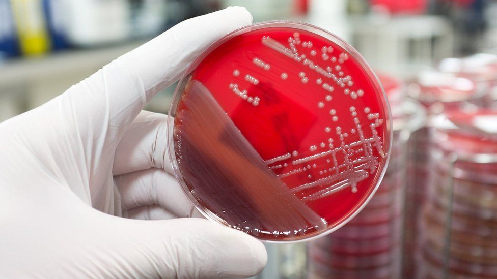 Antibiotic resistant infections
