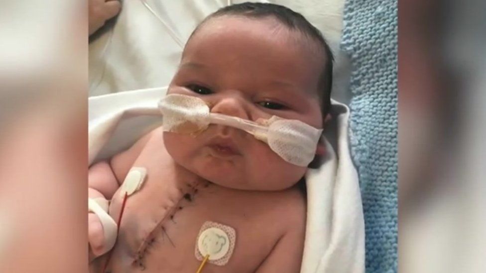 Reggie as a baby in hospital