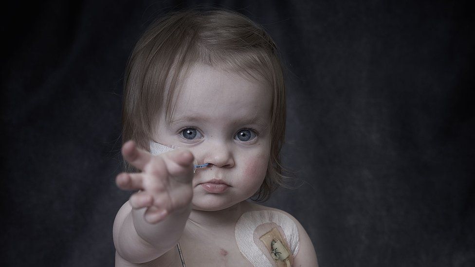 A young girl with medical equipment attached to her chest and nose holds her hand out to the camera