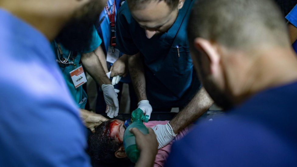 Doctors treat an injured child at the Kuwaiti Specialist Hospital in Rafah, in the southern Gaza Strip (8 May 2024)