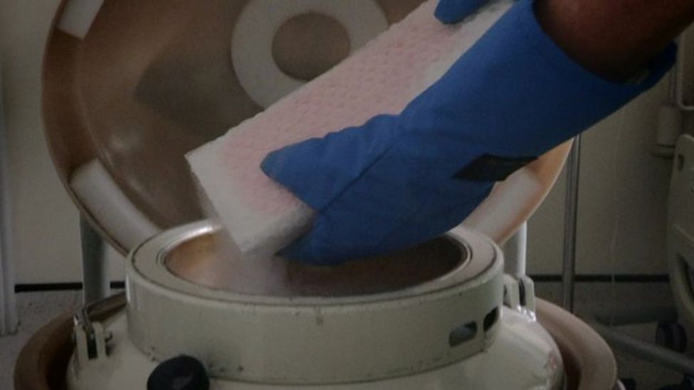 Cancer Treatment For Ms Patients Gives Remarkable Results Bbc News