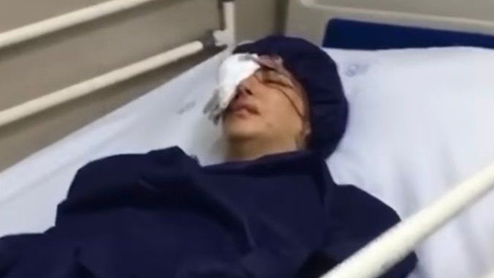 Элаге Тавоколян попала в больницу после ранения в глаз