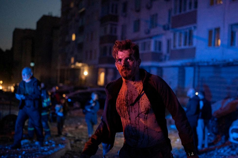 An injured man stands next to an apartment building in Kyiv, Ukraine damaged during a massive Russian drone strike - 30 May 2023. Pablo Petrov/Press service of the State Emergency Service of Ukraine