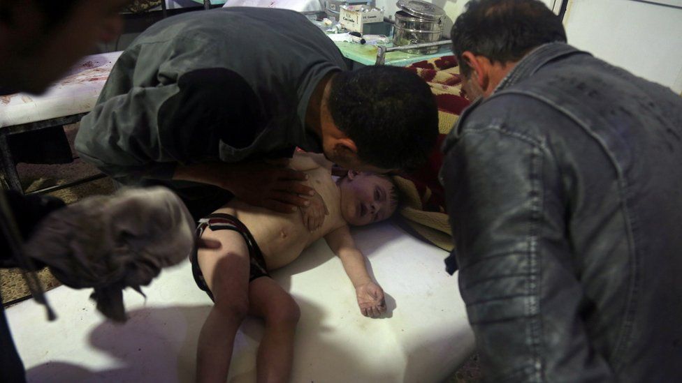 A child is treated at a hospital in Douma, eastern Ghouta in Syria, after a suspected chemical attack (7 April 2018)