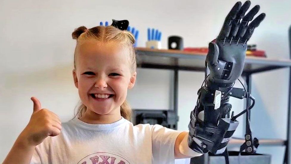 Children with limb difference to get 'life-changing' prosthetic arms - BBC  News
