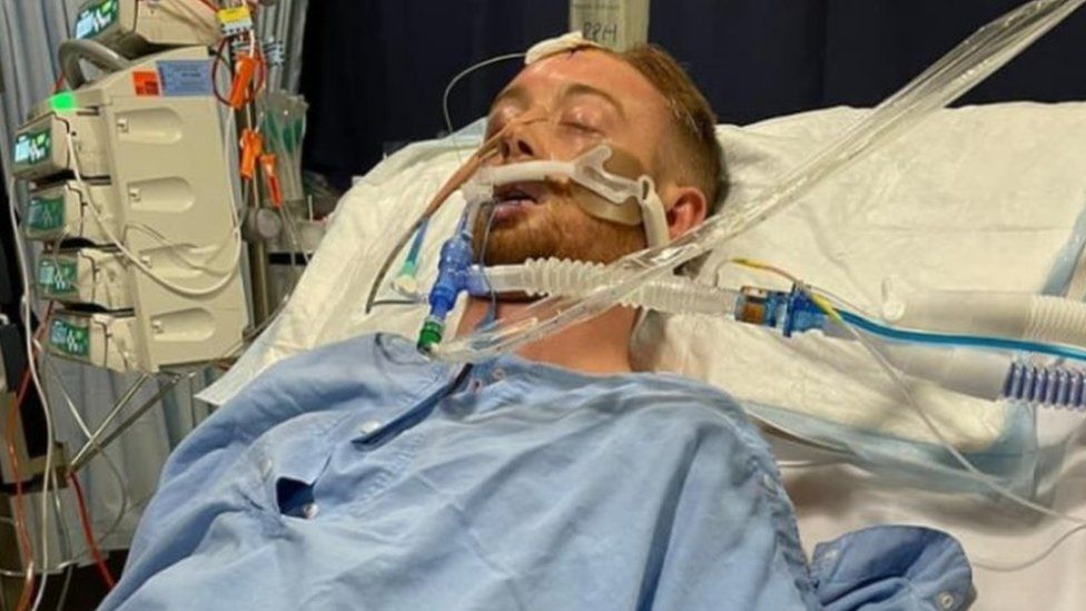 Danny Hodgson connected to plastic tubes in his hospital bed