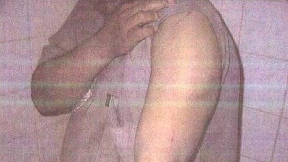 Unknown detainee shows his arm in undated photo released by the Pentagon on 5 February 2016