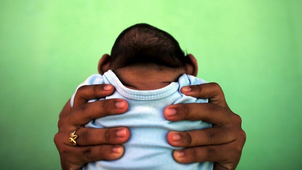 Hands holding a baby with a small head, caused by brain damage from Zika virus