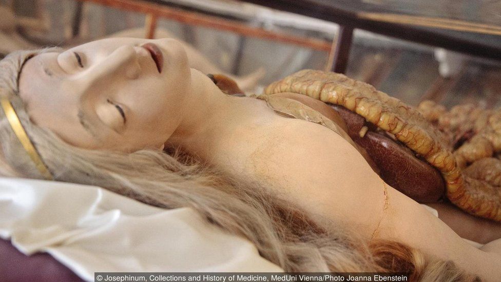 Josephinum, Collections and History of Medicine, MedUni Vienna/Photo Joanna Ebenstein