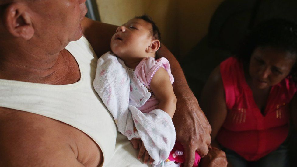 Three-month-old Alice Vitoria Gomes Bezerra, who has microcephaly, held by her father Joao Batista Bezerra in Recife, Brazil. 27 Jan 2016