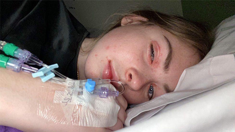 Elle Gorman lying on a hospital bed with a facial rash, swollen eye and cannula in her hand