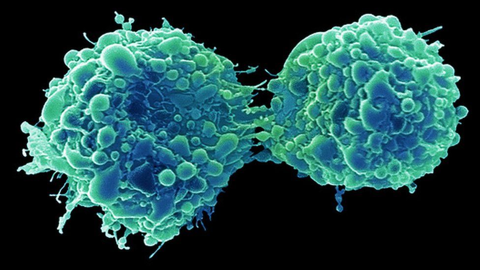 Dividing bladder cancer cells