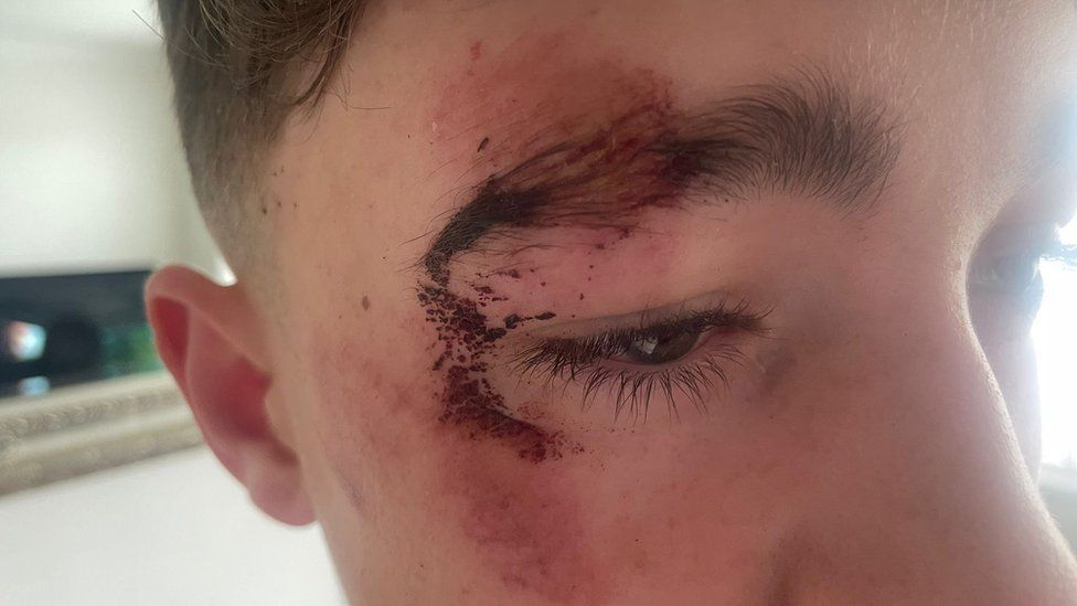 Head teacher apologises after pupils hurt in crush