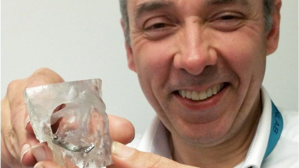 Peter Llewelyn Evans with a 3D printed implant for a fractured eye socket