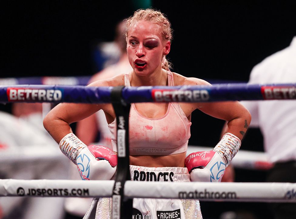Ebanie Bridges of Australia with bad eye injury after her world WBA Bantamweight defeat over 10 rounds against rival Shannon Courtenay