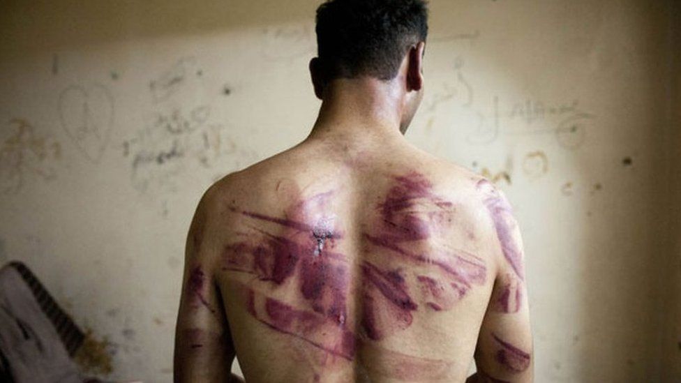 Сирийская жертва пыток (архивное фото)