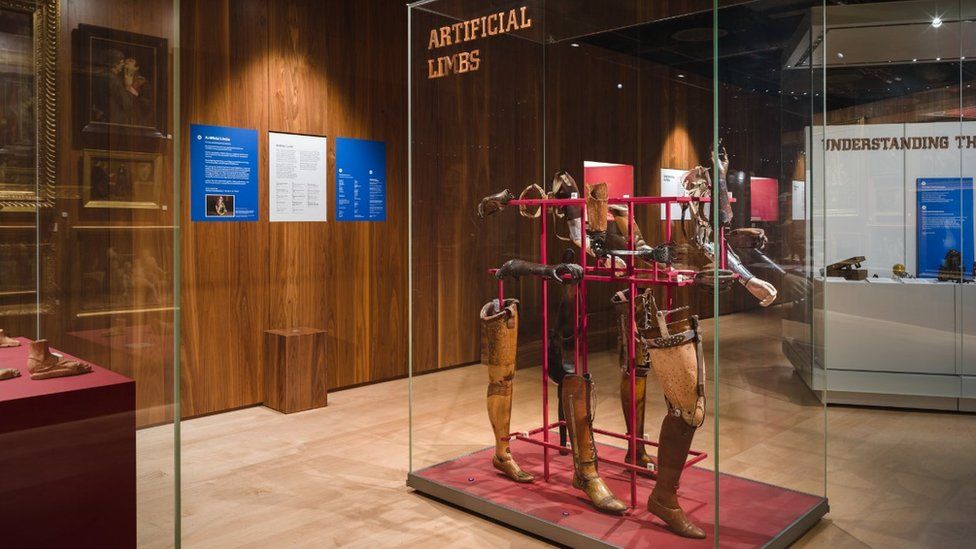 Artificial limbs on display at the Wellcome Collection