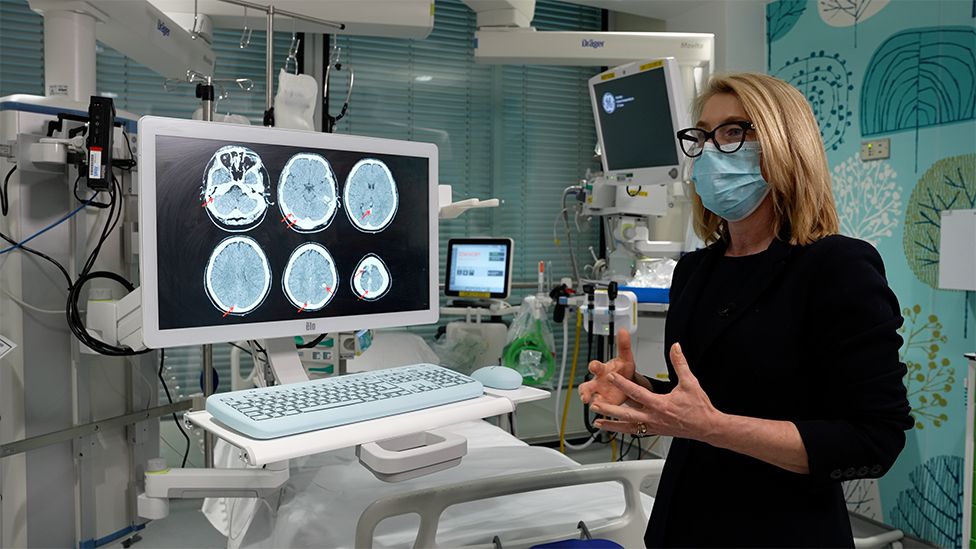 Профессор Скалли с несколькими снимками МРТ, показывающими связанный с вакциной тромбоз в головном мозге