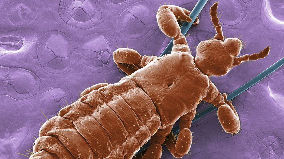 SEM photo of a head lice