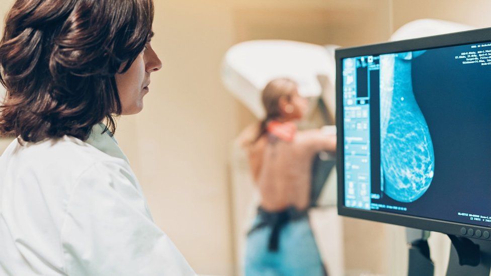 Mammogram