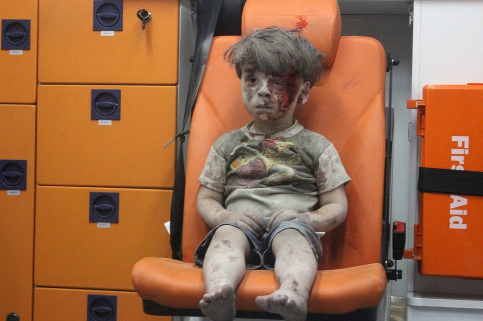 Омран Дакниш, четырехлетний сирийский мальчик, покрытый пылью и кровью, сидит в машине скорой помощи после того, как его спасли из-под обломков здания, пострадавшего от авиаудара в удерживаемом повстанцами районе Катерджи в северном сирийском городе Алеппо. 17 августа 2016 г.
