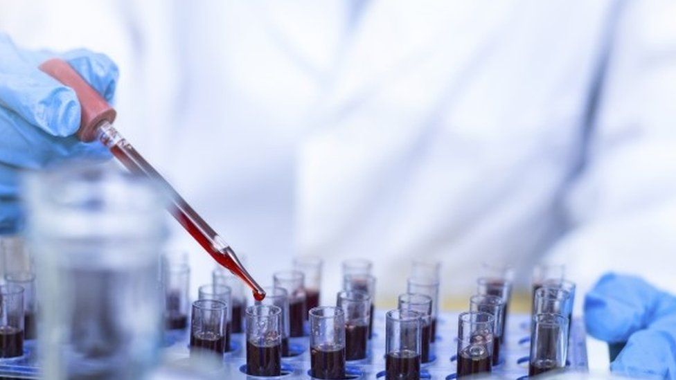 Covid Speed of Lighthouse lab test results falls again BBC News