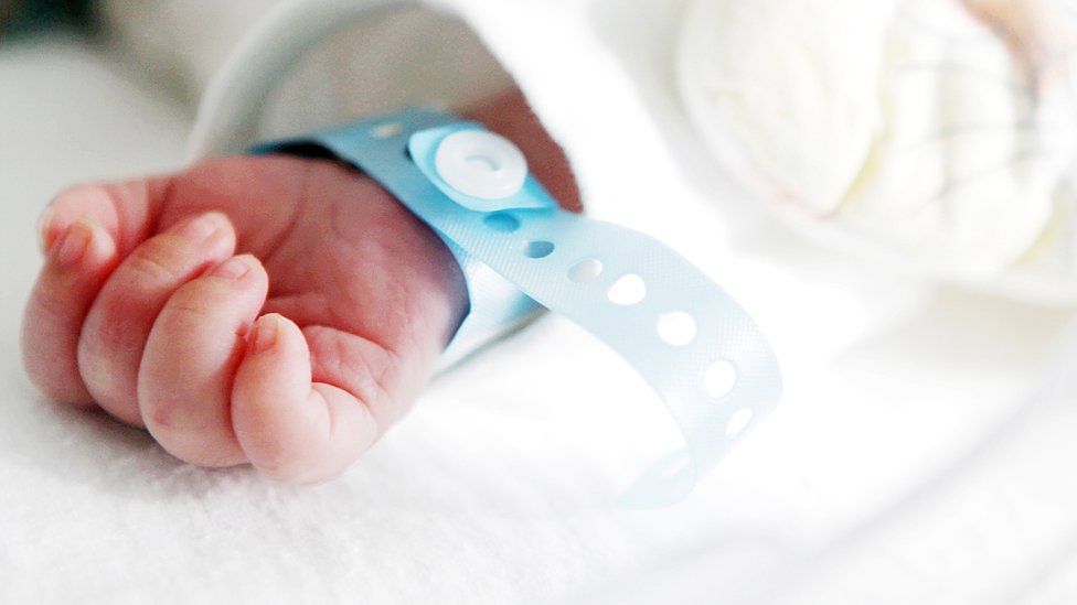 Новорожденный ребенок с идентификационным браслетом