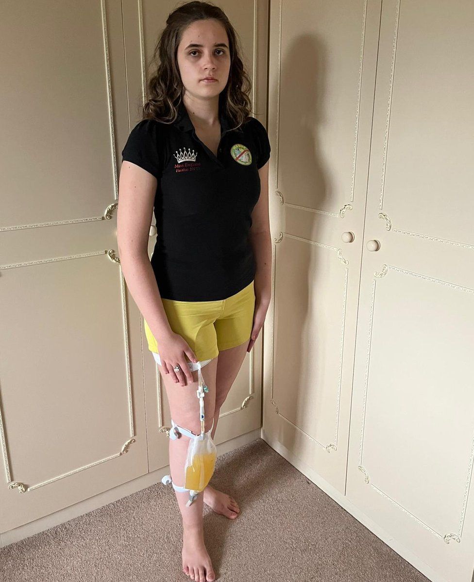Jennifer Carless wearing a catheter on her leg