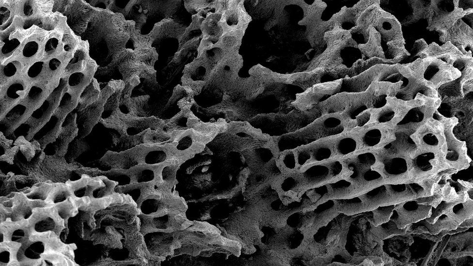 Electron micrograph of heat-damaged coral