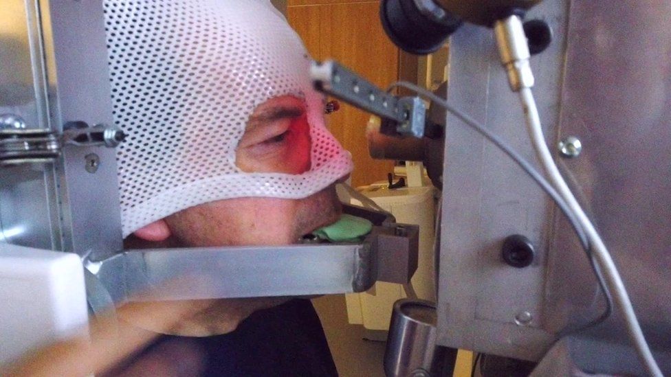 Rory Cellan-Jones in an eye cancer mask