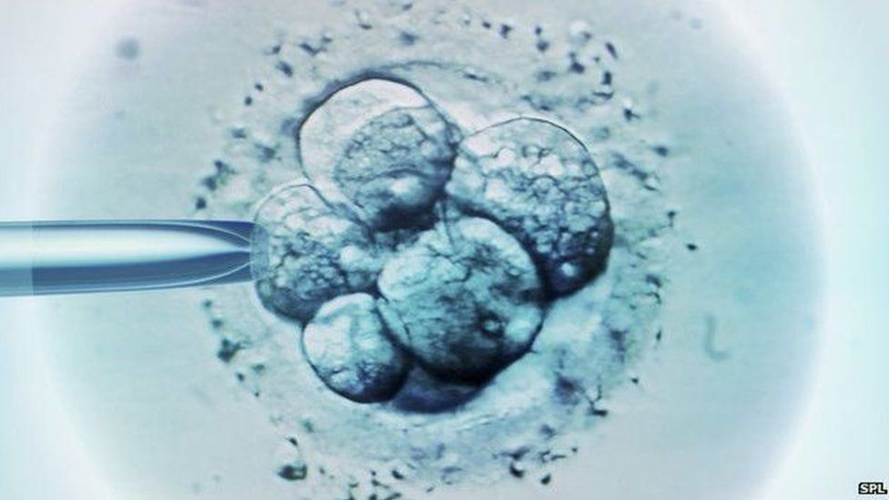 IVF under microscope