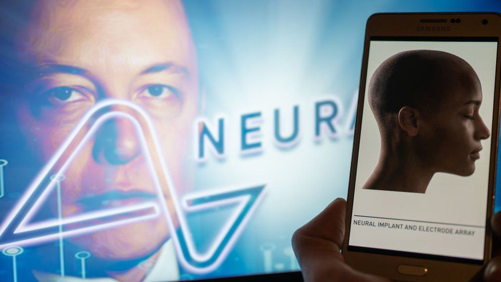 Elon Musk announces first Neuralink wireless brain chip implant