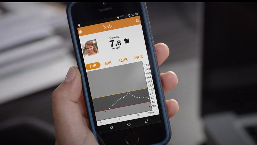 Mobile showing glucose level reading
