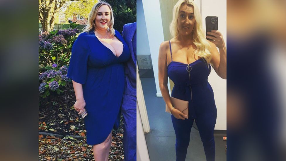 Steph Moore before and after weight loss surgery