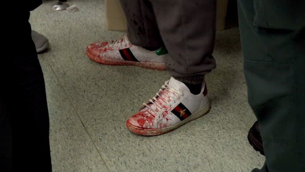Bloodied trainers