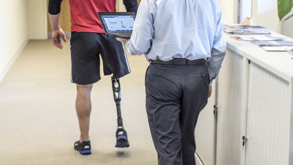prosthetic leg being calibrated