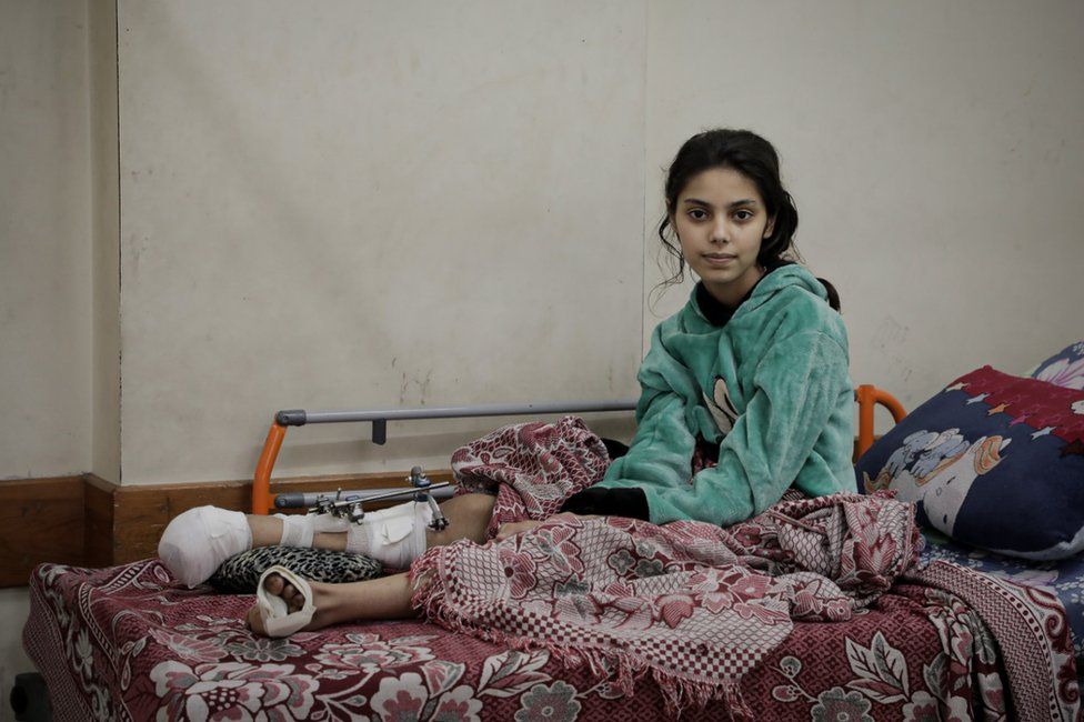 Rafeef Dughmoush, whose leg was shattered by an airstike that killed 11 members of her family. (Mohammed Shahin/BBC)