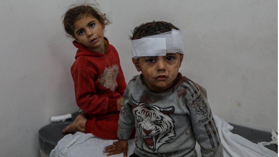 Injured Palestinian children are treated in a hospital in Rafah after Israeli air strikes. Photo: 12 February 2024