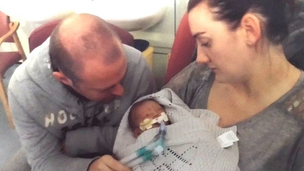 Parents cradling a baby with tubes going into his mouth.