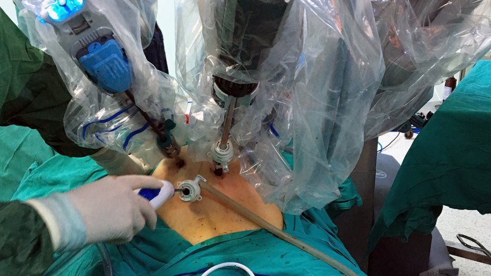 complicaciones después de una cirugía robótica de próstata