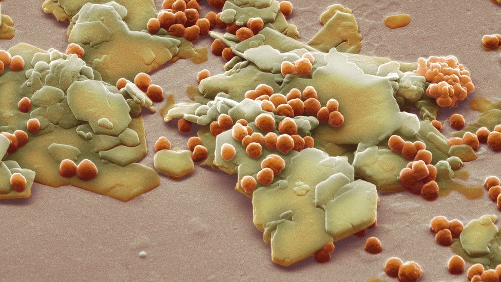 scrub particles seen under microscope