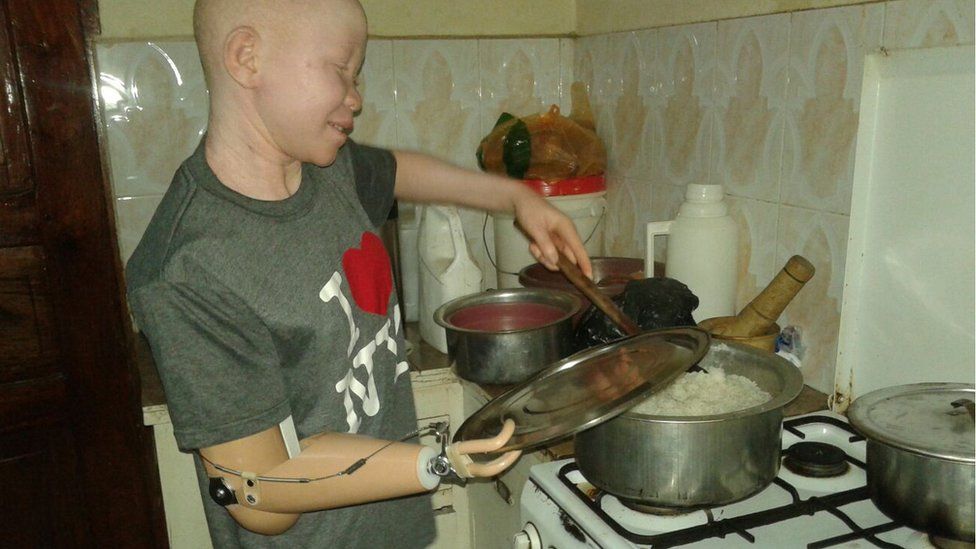 Albino child cooking