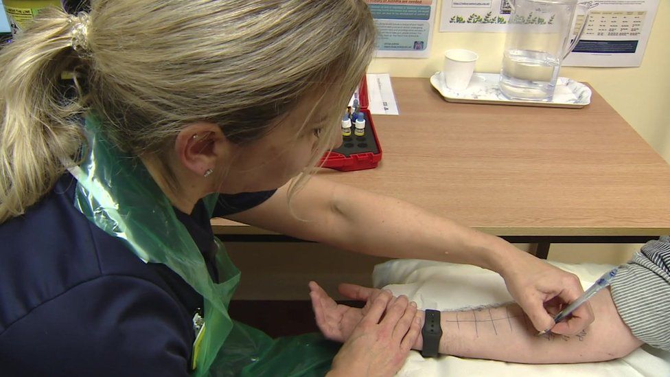 researcher doing allergy test on man's arm